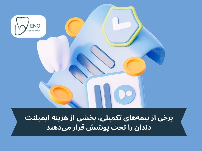 آیا بیمه هزینه ایمپلنت دندان را پوشش میدهد