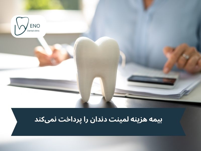 آیا بیمه هزینه لمینت دندان را پرداخت میکند