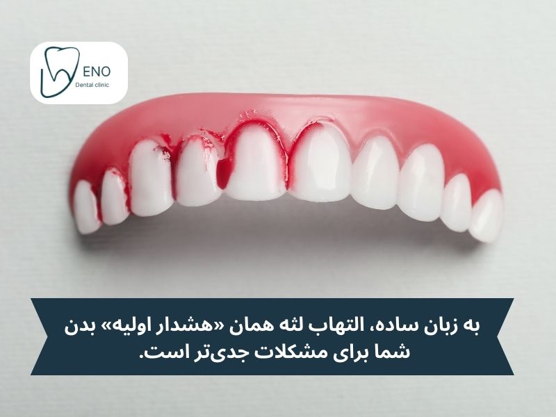التهاب لثه به چه معنا است