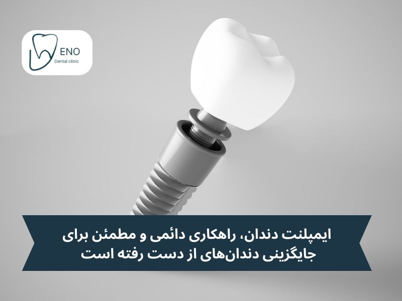 ایمپلنت دندان چیست و چرا اهمیت دارد