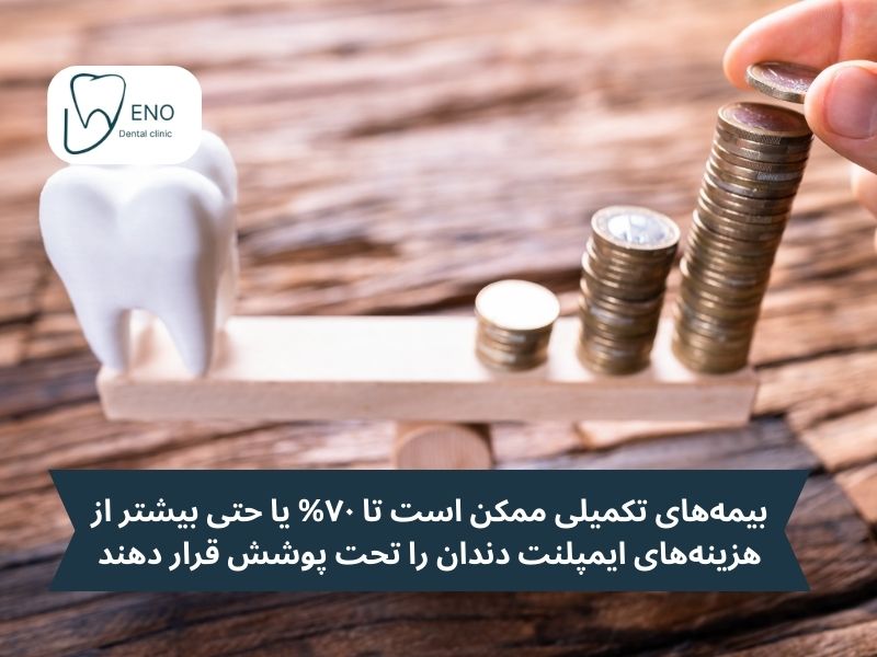 بیمههای تکمیلی ممکن است تا ۷۰% یا حتی بیشتر از هزینههای ایمپلنت دندان را تحت پوشش قرار دهند