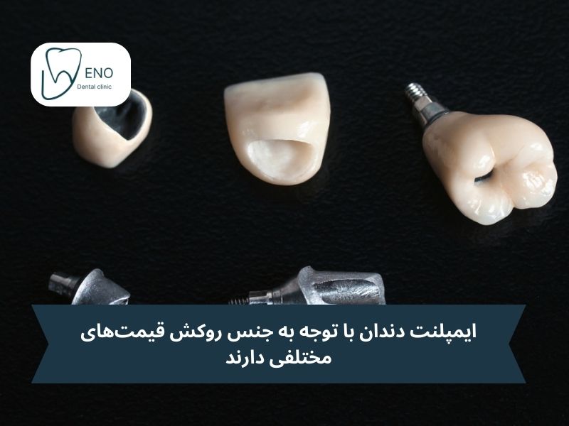 جنس روکش ایمپلنت
