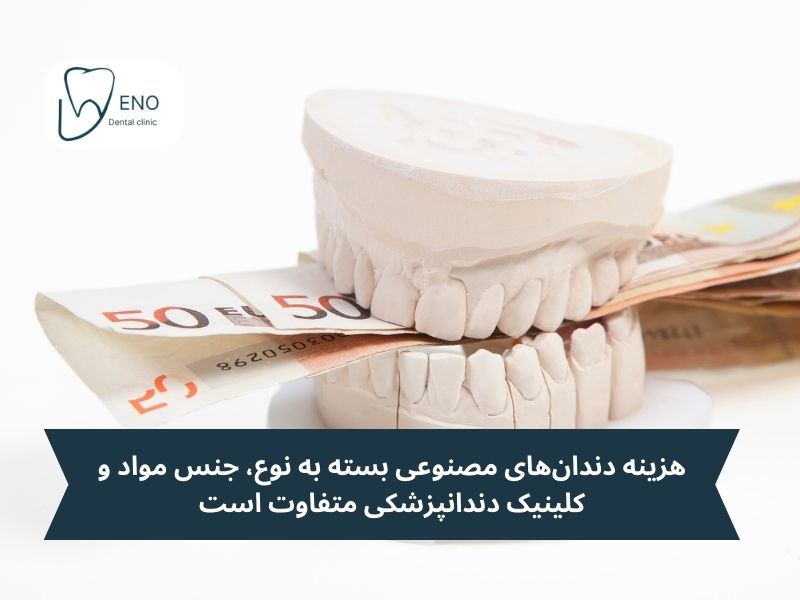 دندان مصنوعی؛ کاشت دندان بدون ایمپلنت با قیمت مناسب