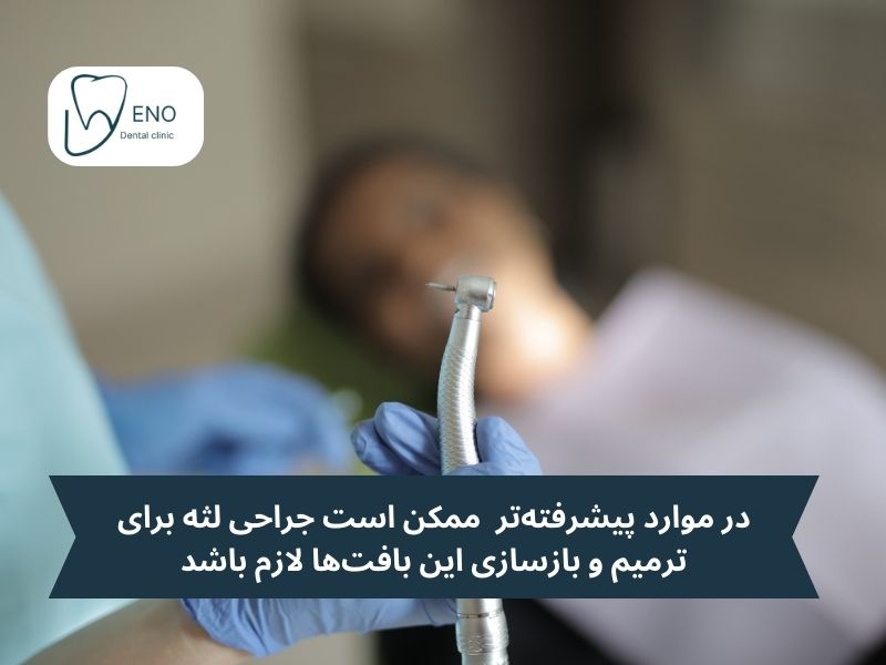 روشهای حرفهای درمان التهاب لثه