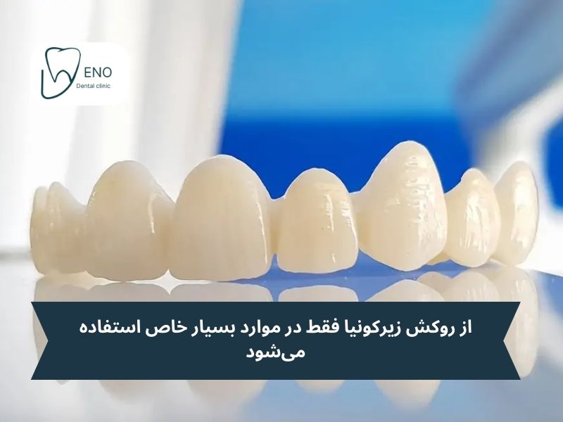 روکش زیرکونیا
