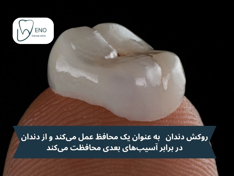 ضرورت روکش دندان عصب کشی شده