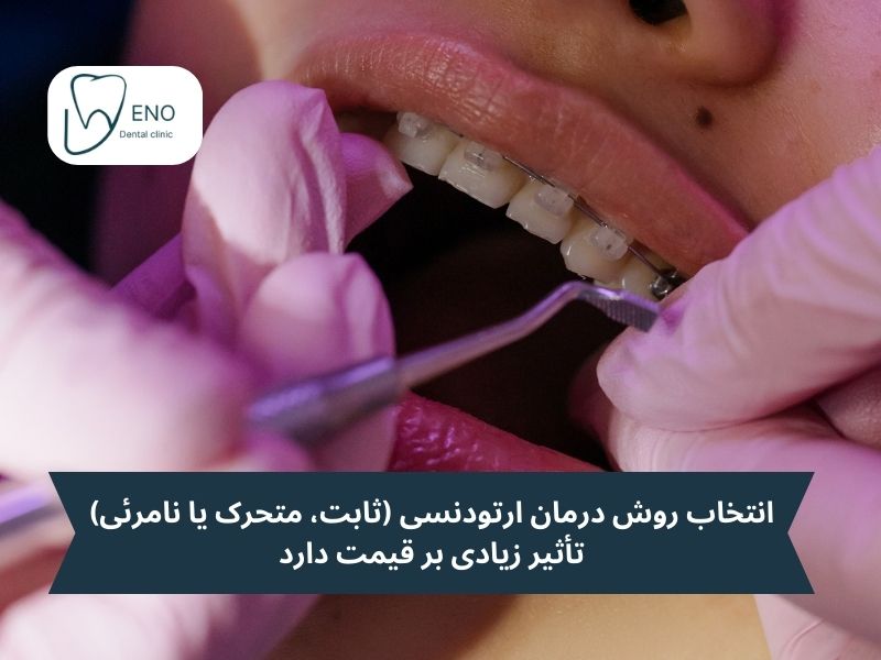 عوامل مؤثر بر هزینه ارتودنسی دندان