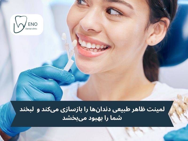 لمینت دندان چیست؟ علت استفاده از لمینت دندان
