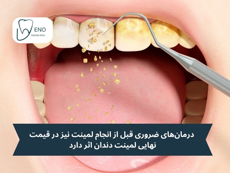 هزینههای جانبی را در نظر بگیرید! هزینه درمانهای ضروری