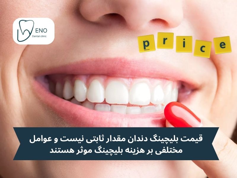 هزینه بلیچینگ دندان