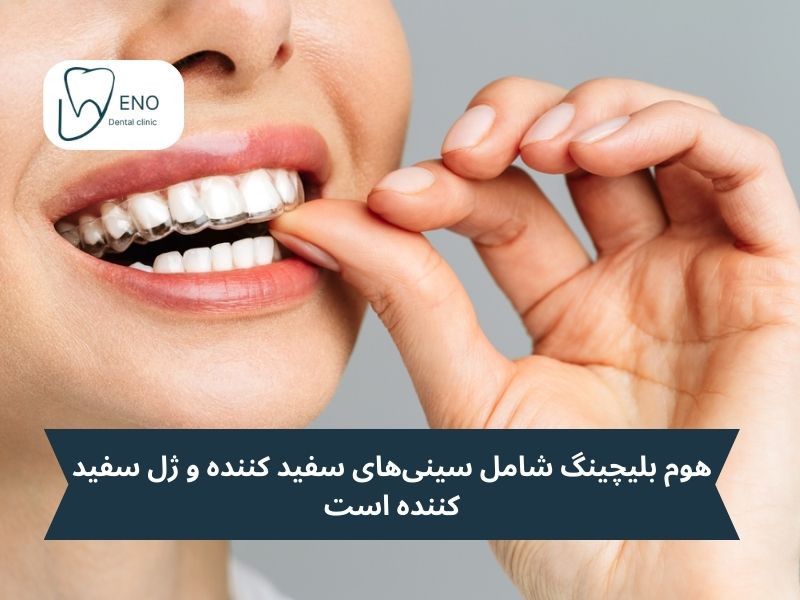 هوم بلیچینگ