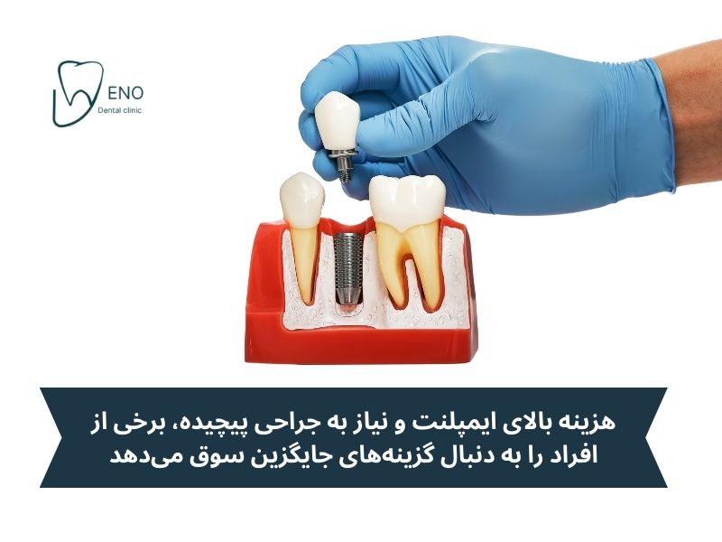 چرا به دنبال جایگزین برای ایمپلنت دندان باشیم