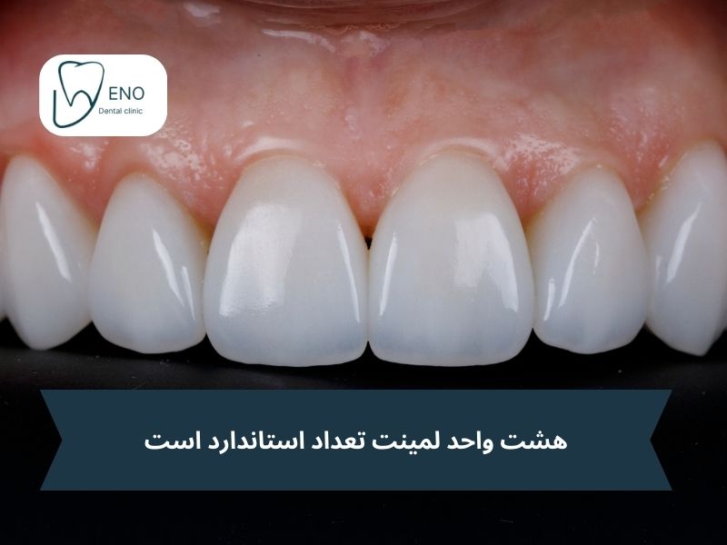 چند واحد لمینت در یک ست کامل وجود دارد؟