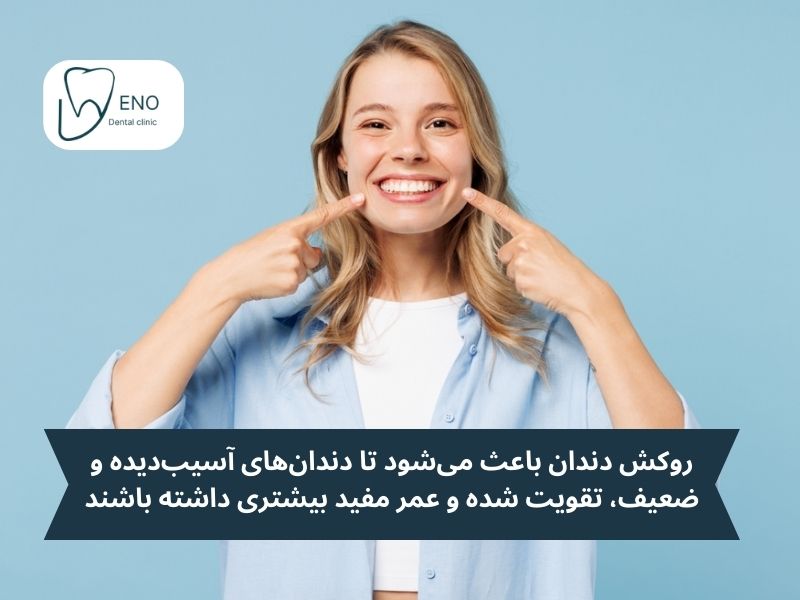 کاربرد روکش دندان