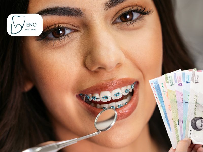 قیمت ارتودنسی دندان