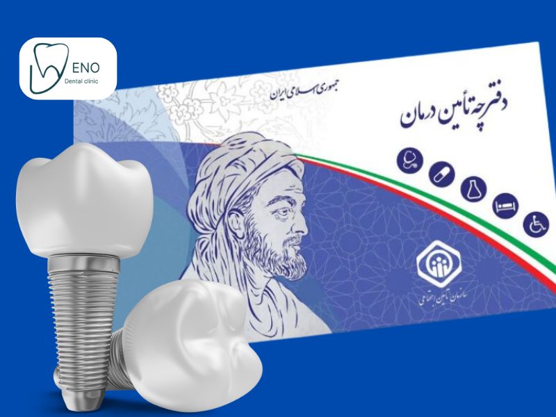 هزینه ایمپلنت دندان با بیمه
