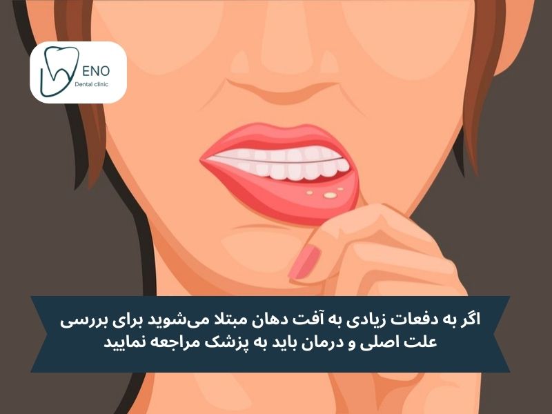 برای آفت دهان چه خوبه