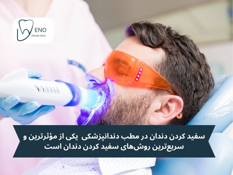 بهترین روش سفید کردن دندان: کدام روش برای شما مناسب است