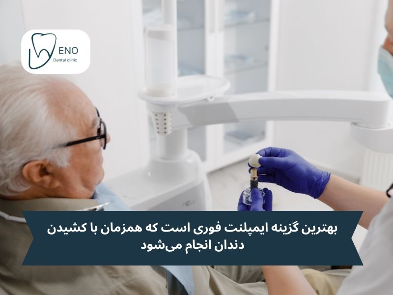 بهترین گزینه ایمپلنت فوری است که همزمان با کشیدن دندان انجام میشود