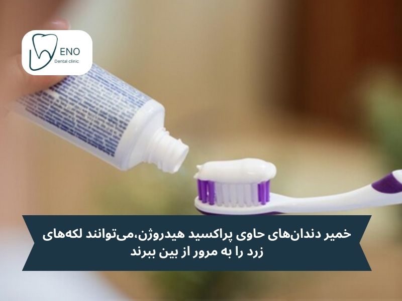 خمیر دندانهای حاوی پراکسید هیدروژن، زغال فعال، فلوراید و سیلیکا میتوانند لکههای زرد را به مرور از بین ببرند.