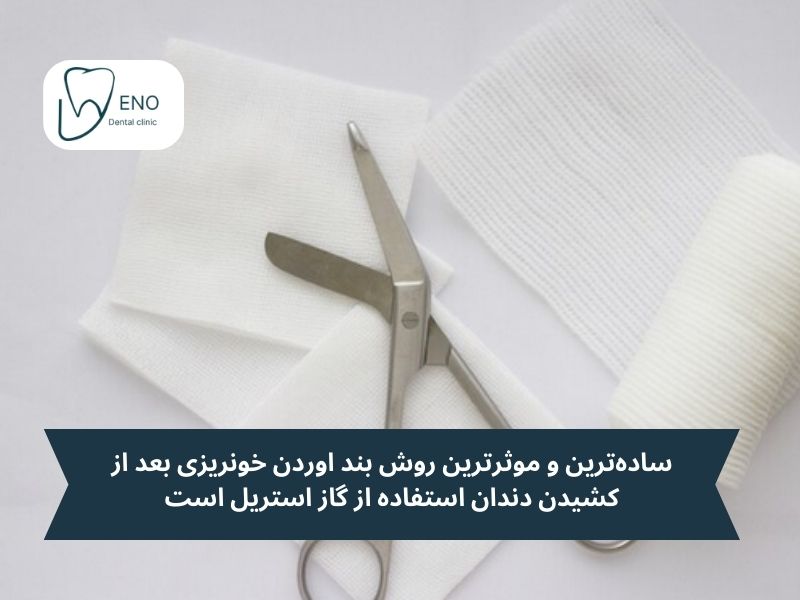 روشهای قطع فوری خونریزی دندان بعد از کشیدن