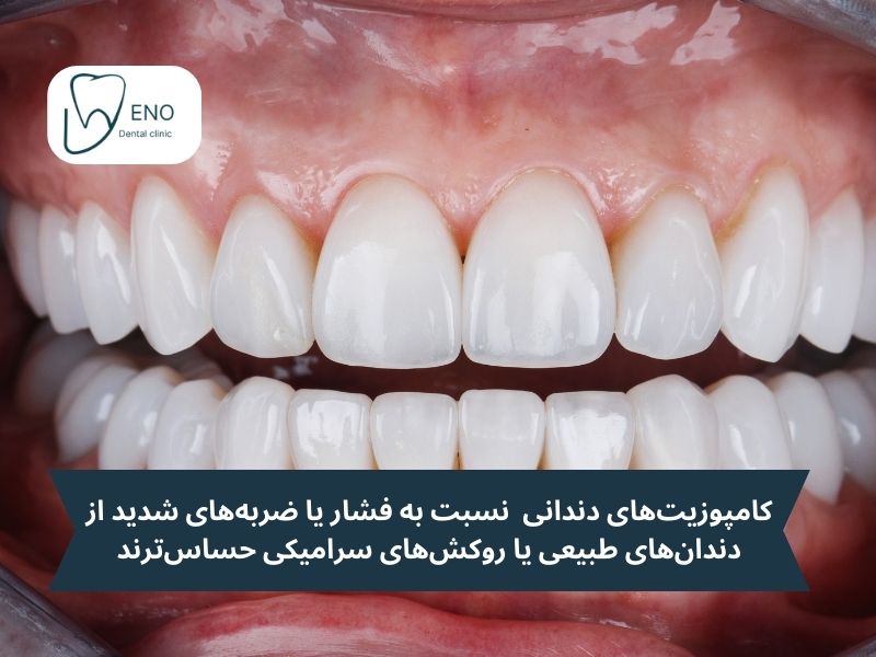 معایب کامپوزیت دندان خرگوشی