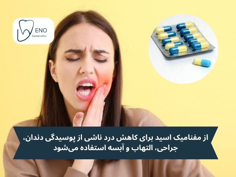 موارد مصرف مفنامیک اسید برای دندان درد