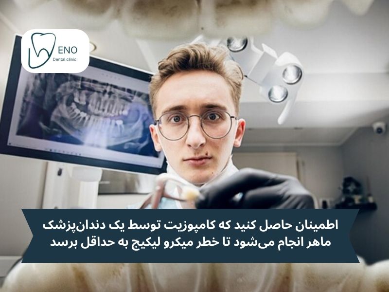 میکرو لیکیج (Microleakage) چیست و چه نقشی در پوسیدگی دندان زیر کامپوزیت دارد