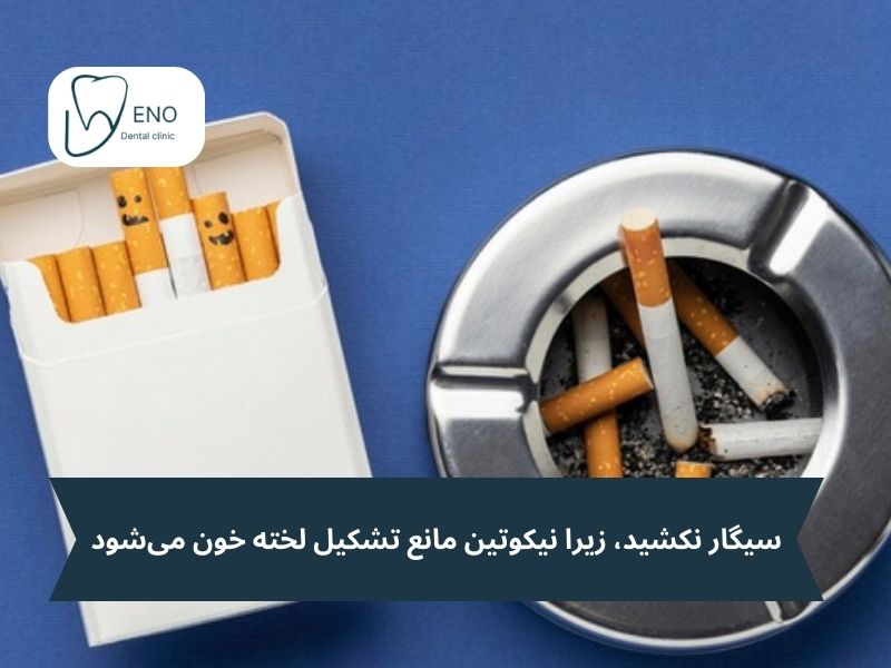چگونه از خونریزی بعد از کشیدن دندان جلوگیری کنیم؟
