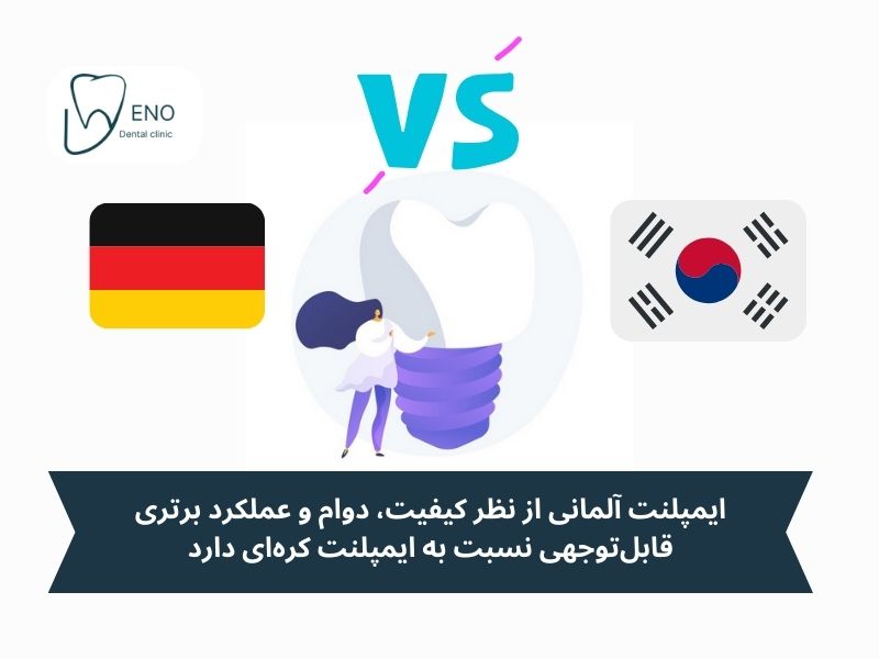 ایمپلنت آلمانی بهتره یا کره ای