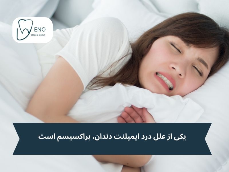 براکسیسم و درد ایمپلنت دندان