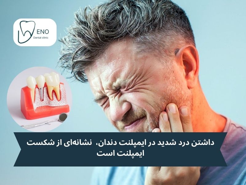 درد نشانه شکست ایمپلنت دندان