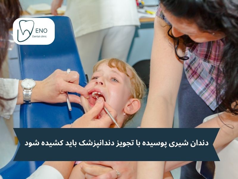 دندان شیری آسیب دیده