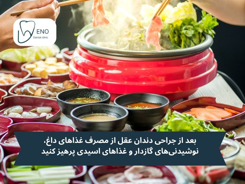 روزهای اول بعد از جراحی دندان عقل چه بخوریم؟ دوران تغذیه حساس و مراقبتی