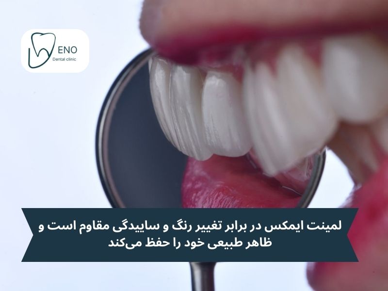 ماندگاری لمینت ایمکس