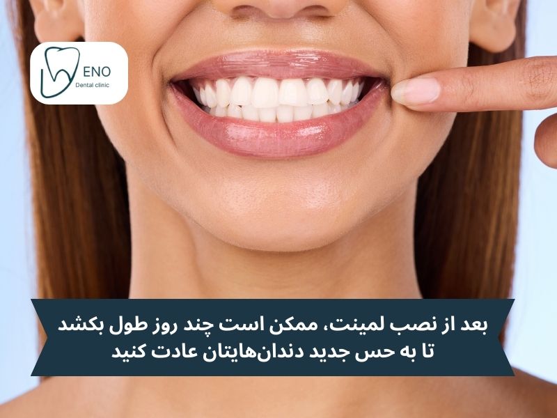 مراحل نصب بهترین لمینت دندان