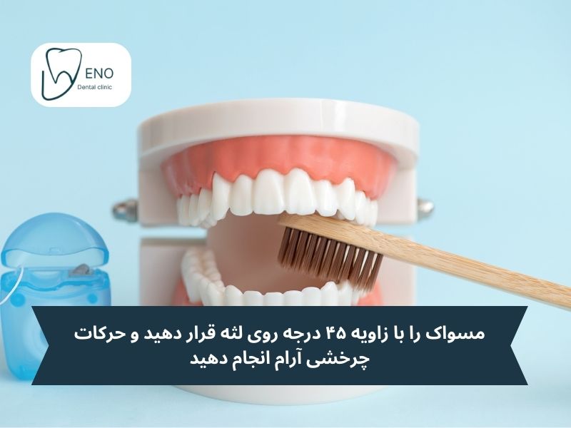 مسواک را با زاویه ۴۵ درجه روی لثه قرار دهید و حرکات چرخشی آرام انجام دهید