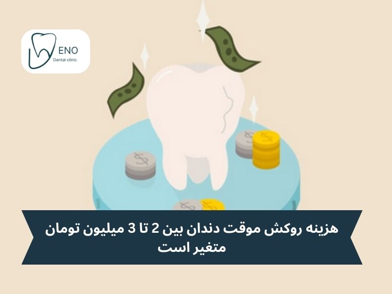 هزینه روکش موقت دندان چقدر است