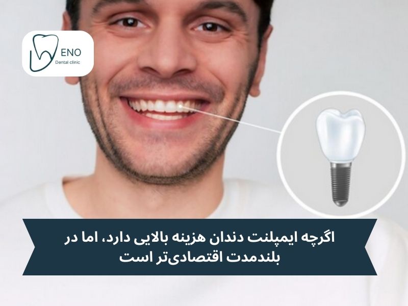 چرا ایمپلنت بهتر است
