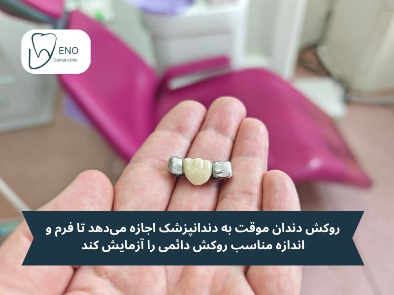 چرا دندانپزشکان استفاده از روکش دندان فوری را ضروری میدانند