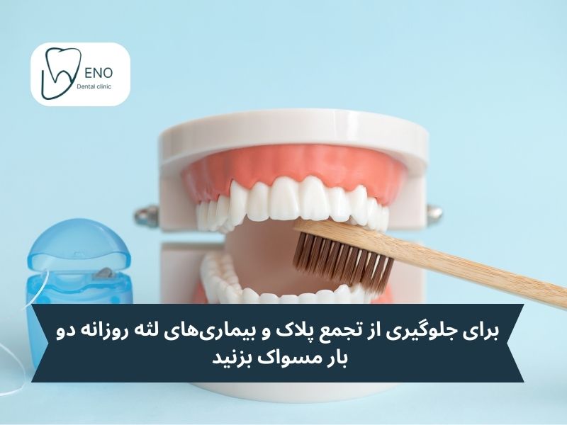 چگونه از لمینت دندان خود مراقبت کنیم تا سالها سالم بماند
