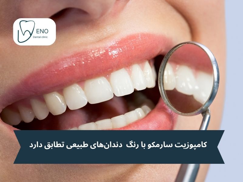 ترمیم لبخند با کامپوزیت دندان سارمکو
