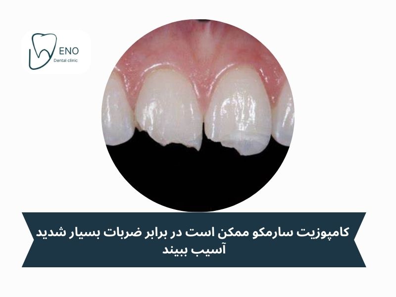 معایب کامپوزیت سارمکو
