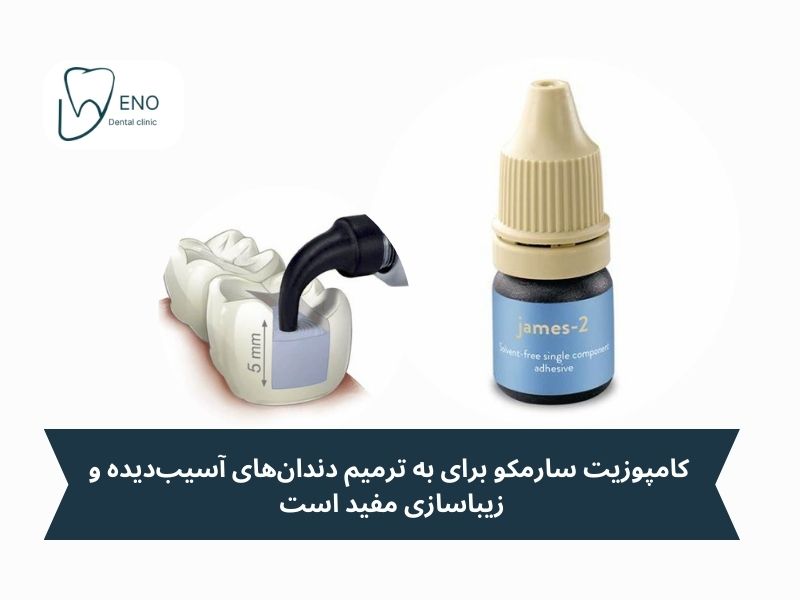 مزایای کامپوزیت سارمکو