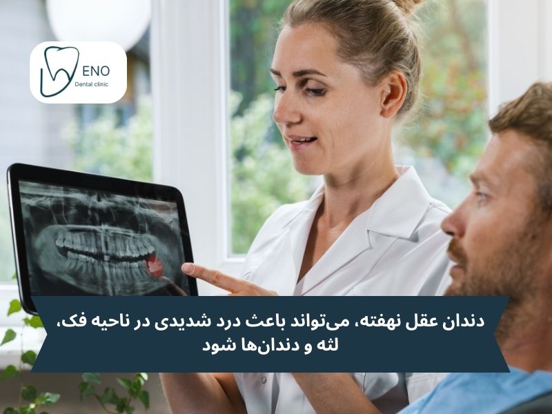 دندان عقل نهفته