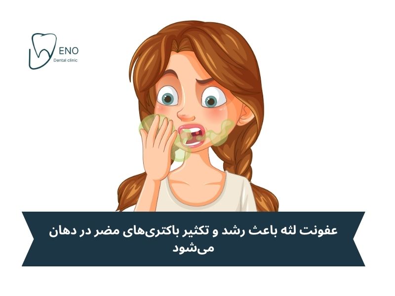 بوی بد دهان (هالیتوز)