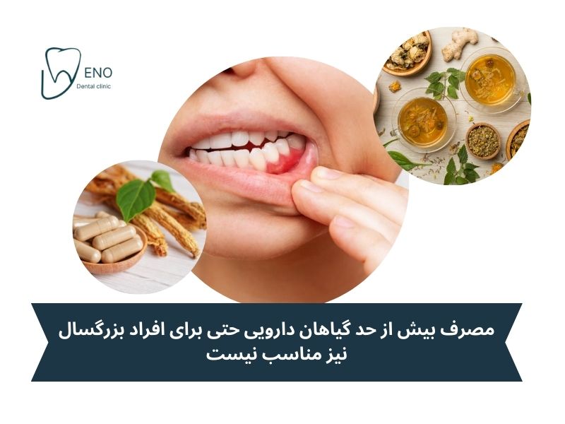 درمان عفونت لثه کودکان در طب سنتی