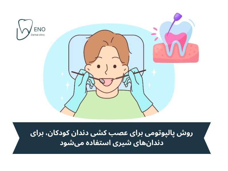انواع عصب کشی دندان کودکان