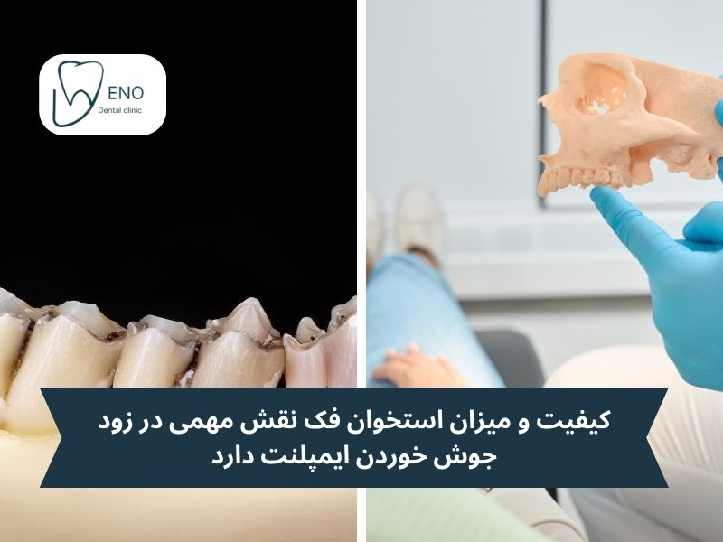 تحلیل استخوان فک