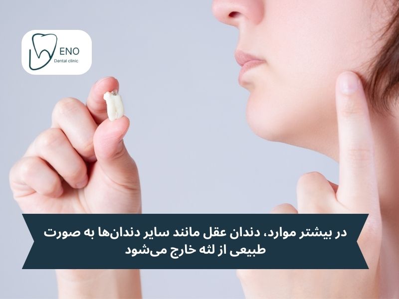 دلایل نهفتگی دندان عقل